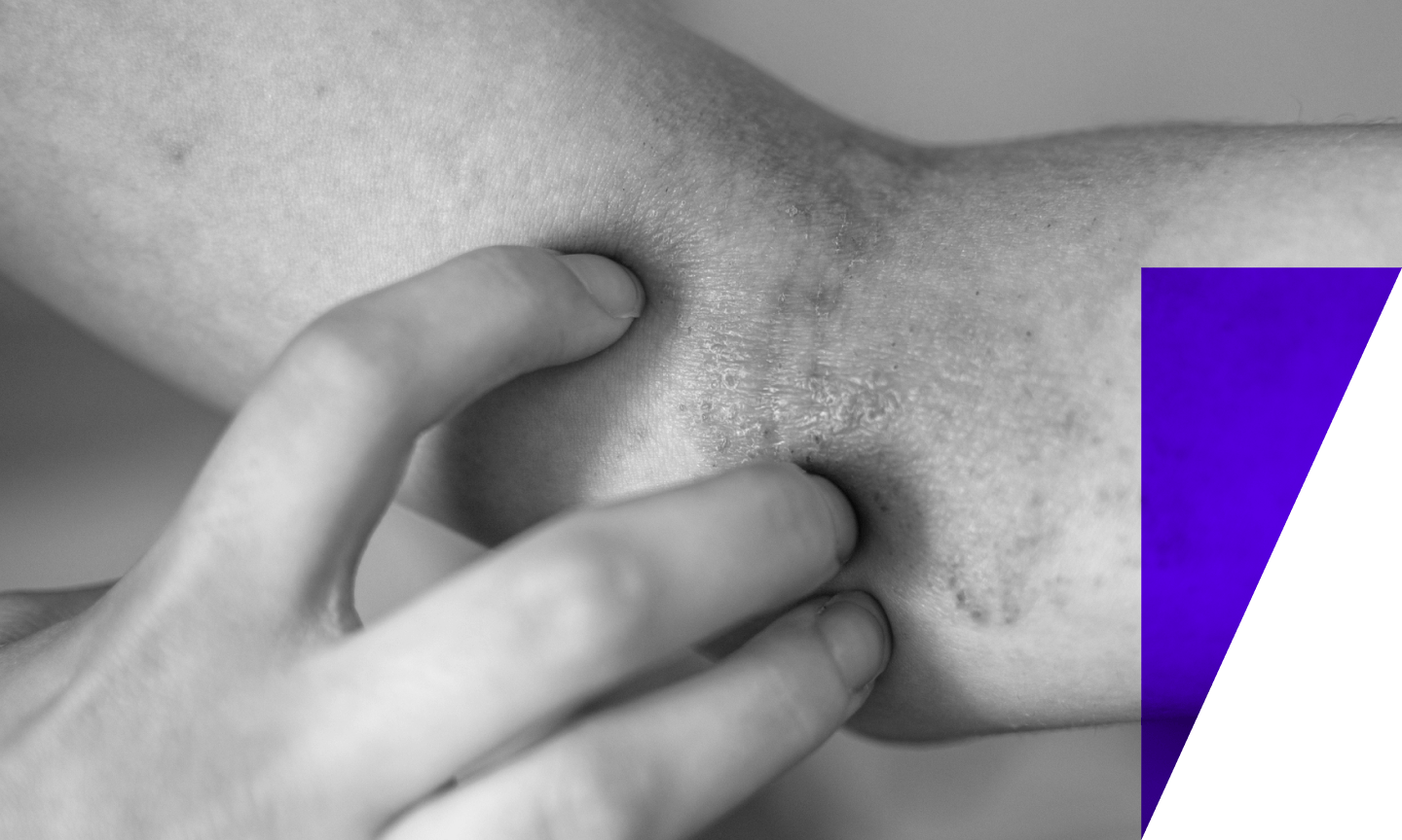 person scratching their skin