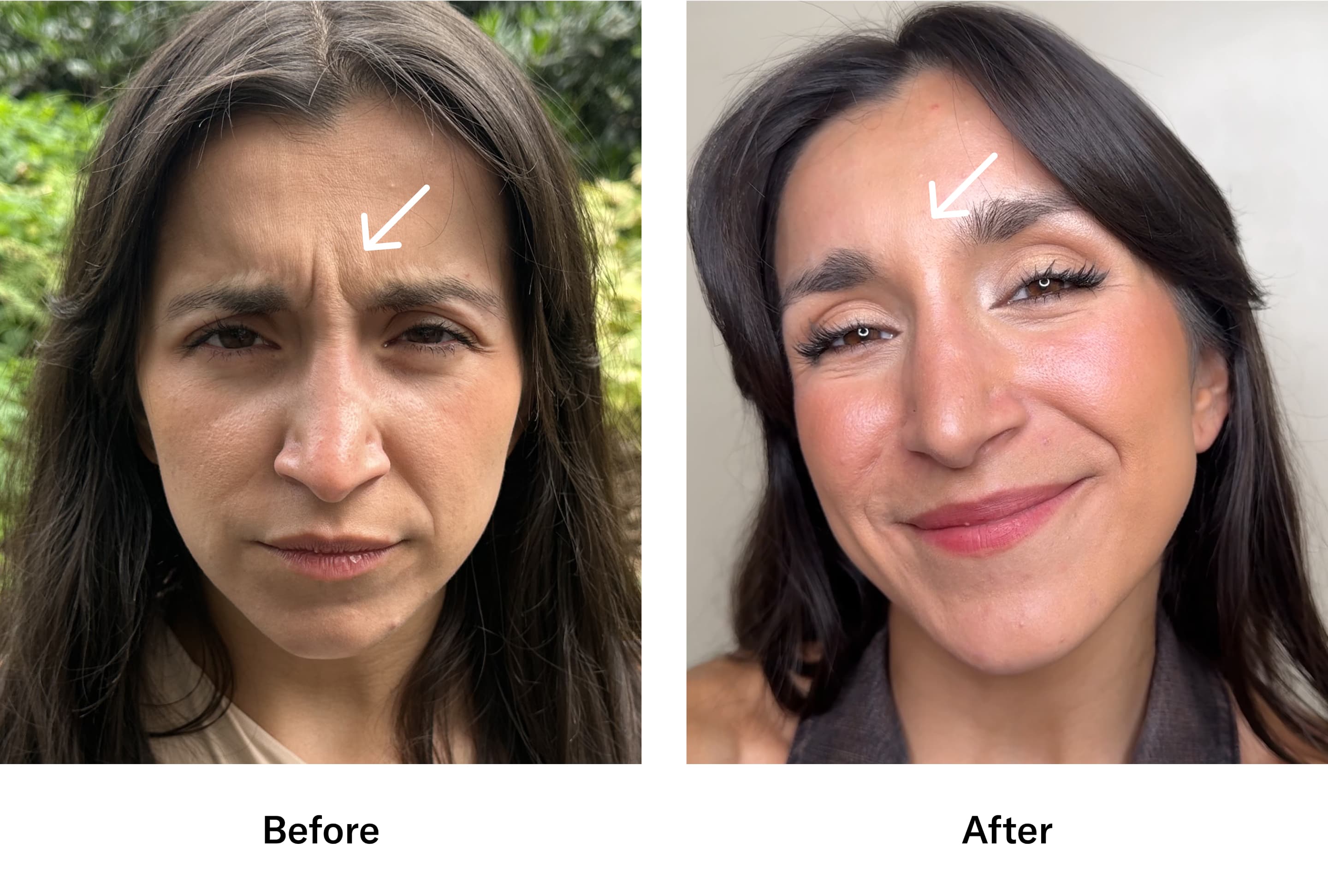 Stefanie before and after