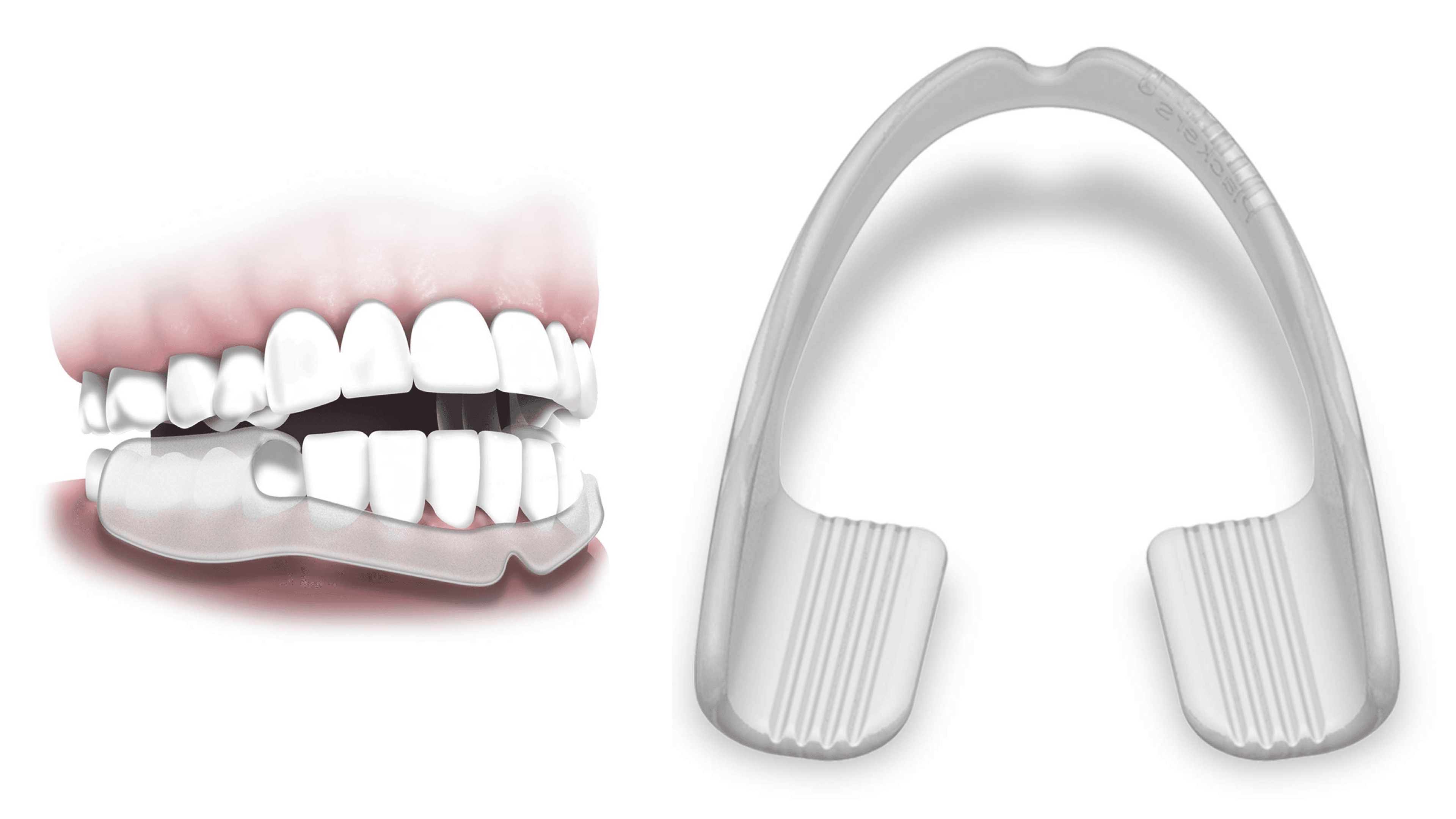 mouth guard to wear while you sleep to prevent grinding