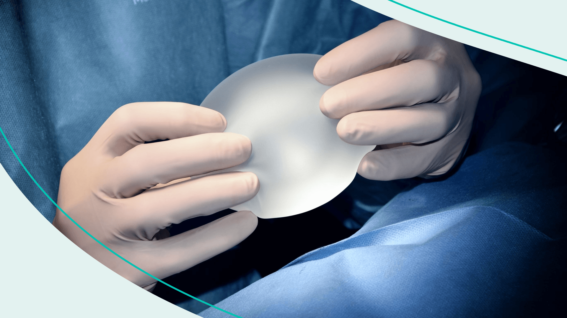 A doctor with white latex gloves holding a breast implant