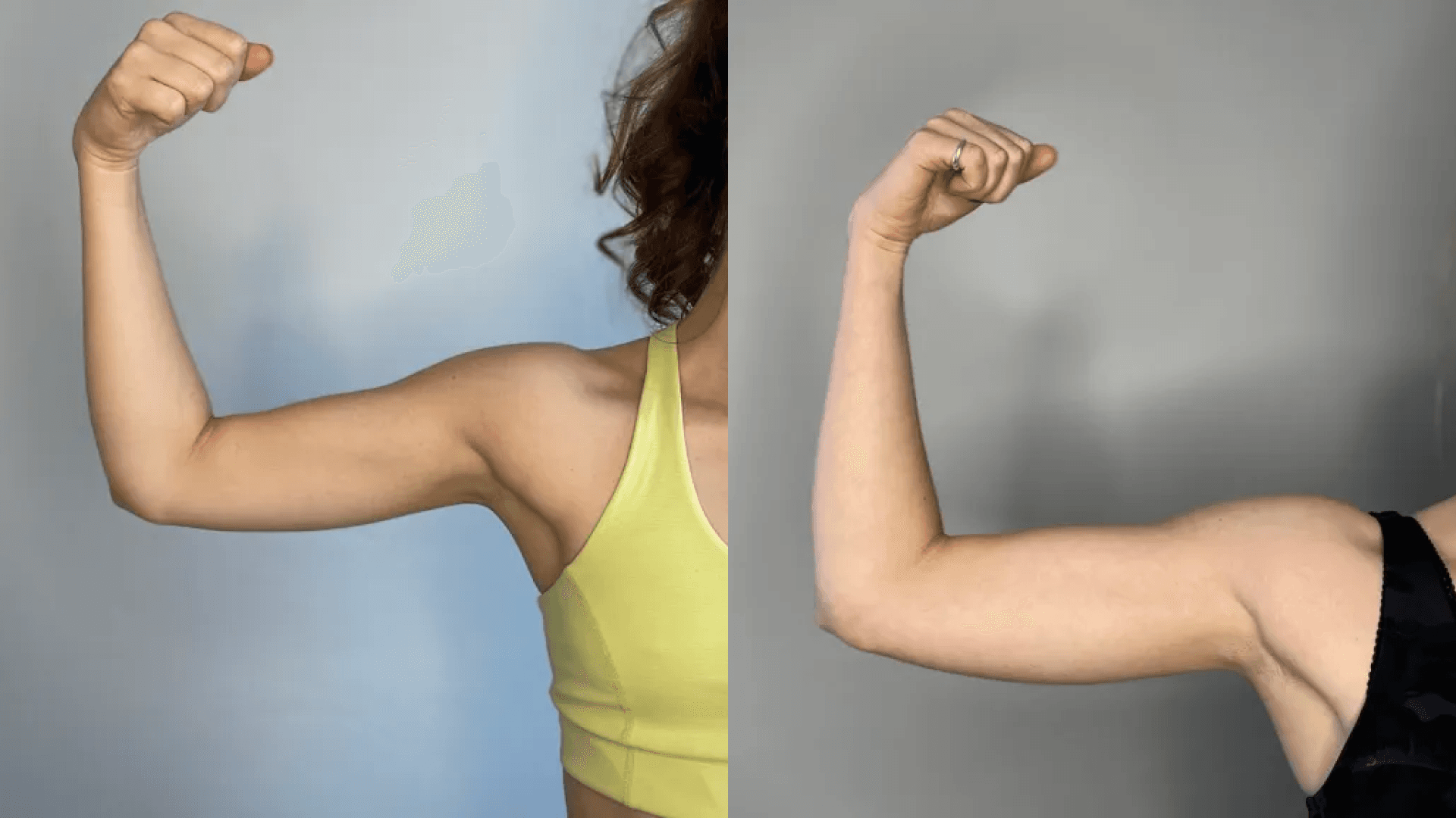 Bala Before and After Arms